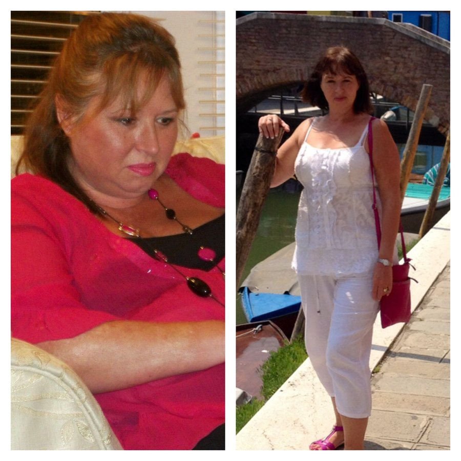 New Leaf Weight Loss Surgery Ltd - Czech Republic - New Leaf Weight Loss Surgery Ltd - Czech Republic