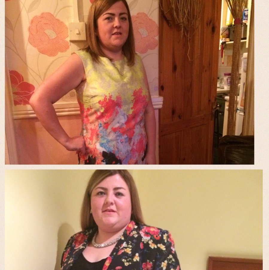 New Leaf Weight Loss Surgery Ltd - Czech Republic - New Leaf Weight Loss Surgery Ltd - Czech Republic