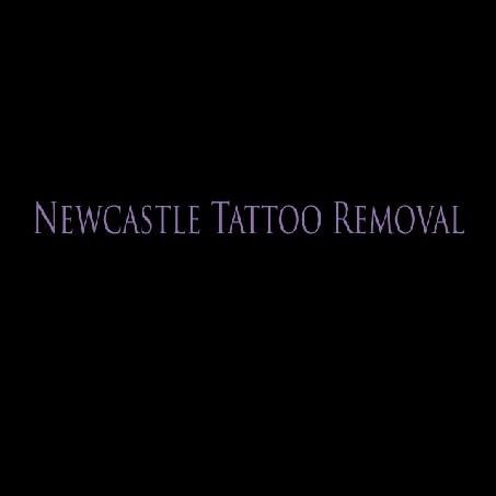 إزالة الوشم نيوكاسل - Newcastle Tattoo Removal