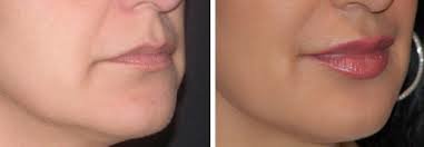 Newcastle Under Lyme Dental Practice - Newcastle Under Lyme Dental Practice