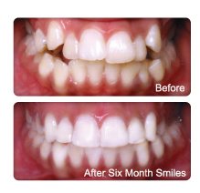 Nicola White - Beau Monde Dental Care - Nicola White - Beau Monde Dental Care