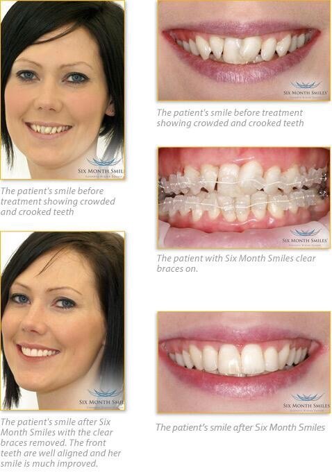 Nicola White - Beau Monde Dental Care - Nicola White - Beau Monde Dental Care