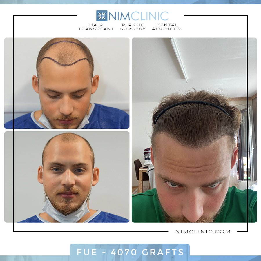 NIMCLINIC - NIMCLINIC