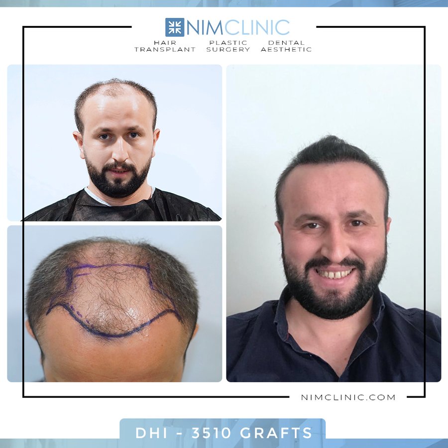 NIMCLINIC - NIMCLINIC