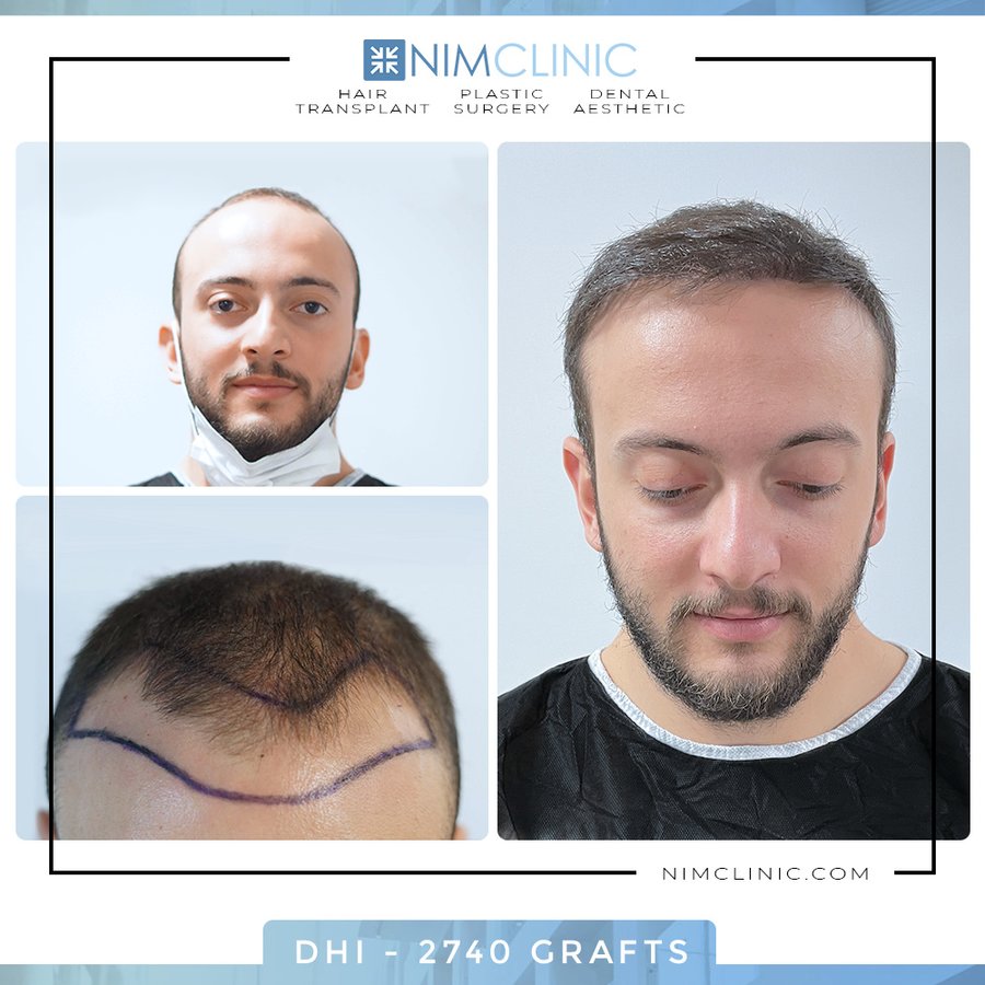 NIMCLINIC - NIMCLINIC