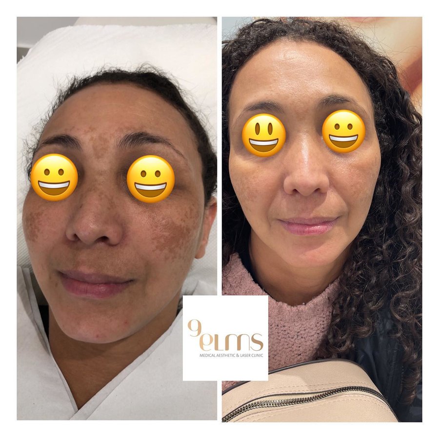 Nine Elms Clinic - Nine Elms Clinic