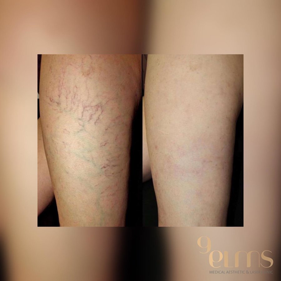 Nine Elms Clinic - Nine Elms Clinic