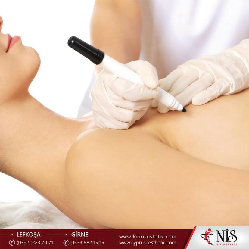 NİS TİP MERKEZİ - NİS TİP MERKEZİ