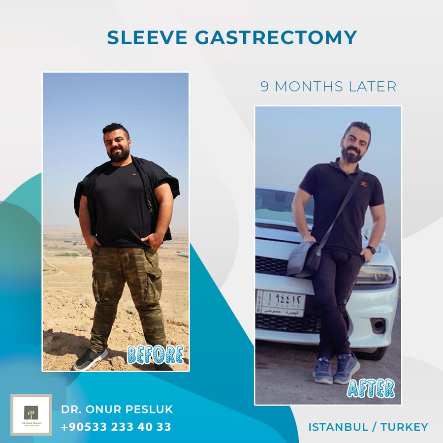 Nisantasi Obesity Clinic - Nisantasi Obesity Clinic