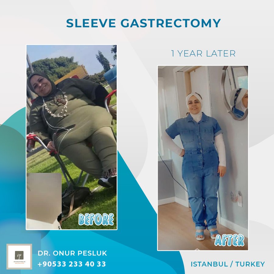 Nisantasi Obesity Clinic - Nisantasi Obesity Clinic