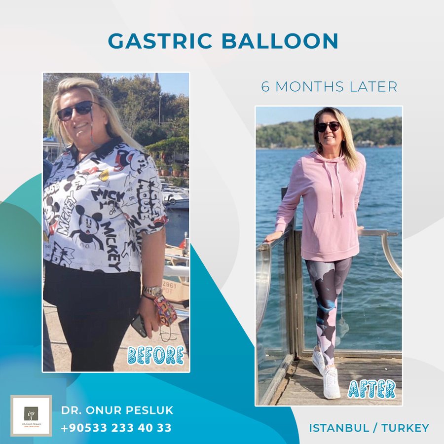 Nisantasi Obesity Clinic - Nisantasi Obesity Clinic