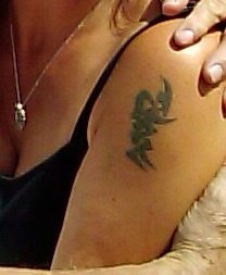 No Regrets Laser Tattoo Removal - No Regrets Laser Tattoo Removal