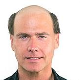 No.1 Hair Replacement - No.1 Hair Replacement