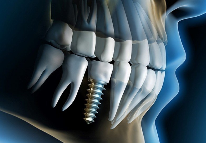 Nogales Periodental - Nogales Periodental