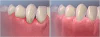 Nogales Periodental - Nogales Periodental