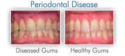 Nogales Periodental - Nogales Periodental