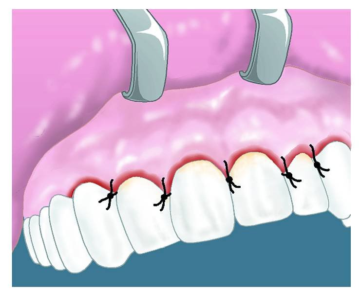 Nogales Periodental - Nogales Periodental