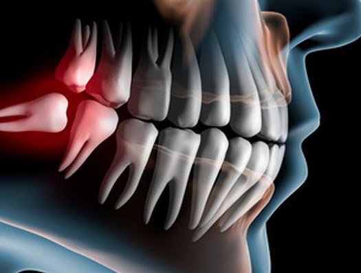 Nogales Periodental - Nogales Periodental