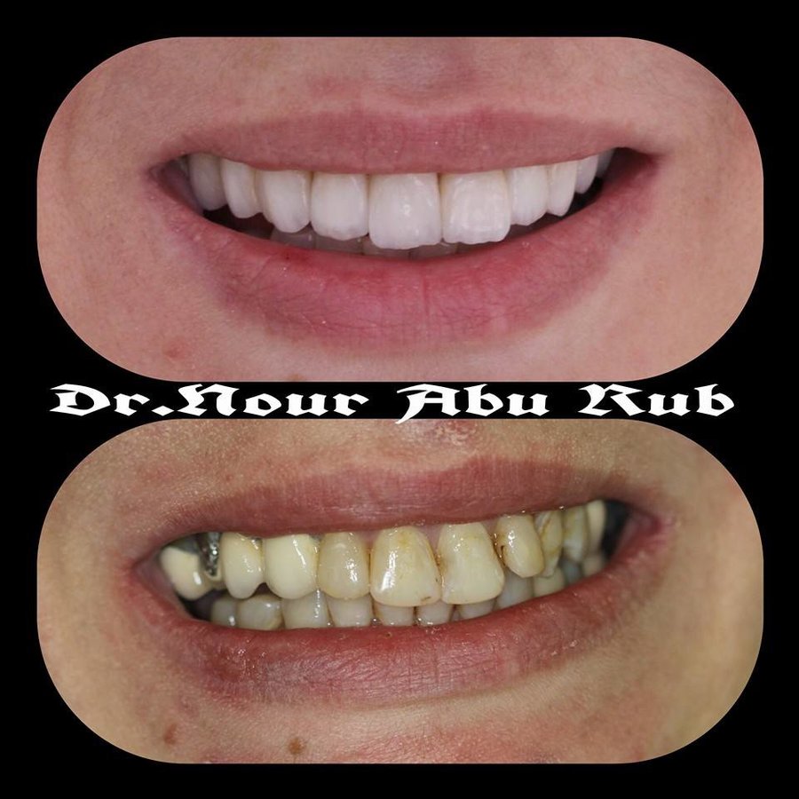 Nour Abu Rub Dental Clinic - Nour Abu Rub Dental Clinic