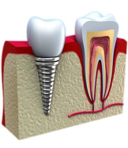 Nour Abu Rub Dental Clinic - Nour Abu Rub Dental Clinic