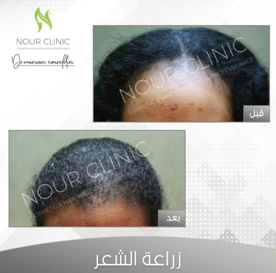 Nour Clinic - Nour Clinic