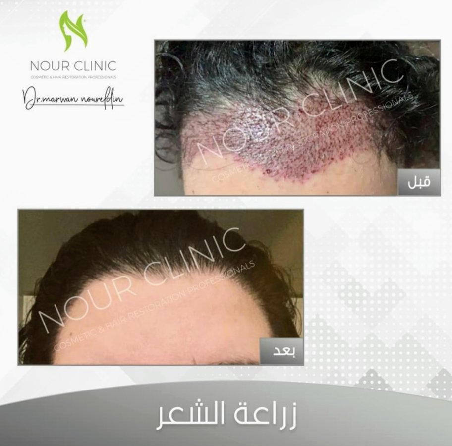 Nour Clinic - Nour Clinic