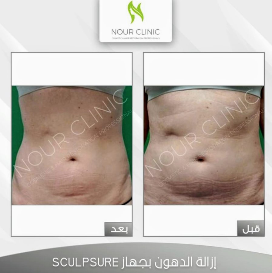 Nour Clinic - Nour Clinic