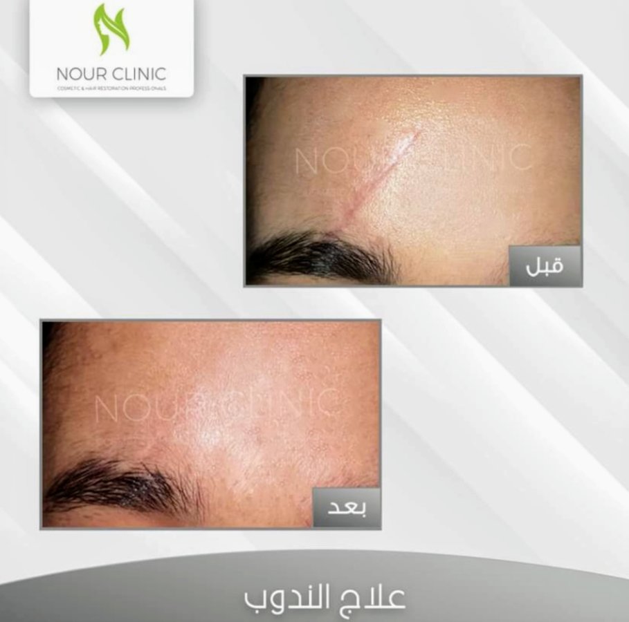 Nour Clinic - Nour Clinic