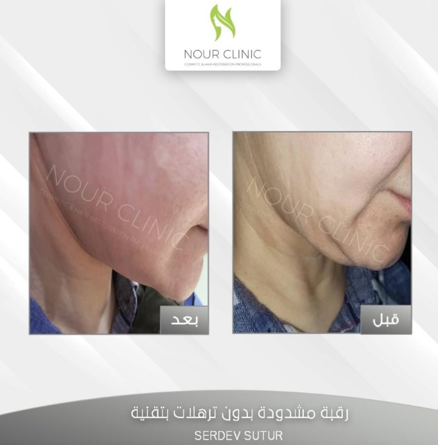 Nour Clinic - Nour Clinic