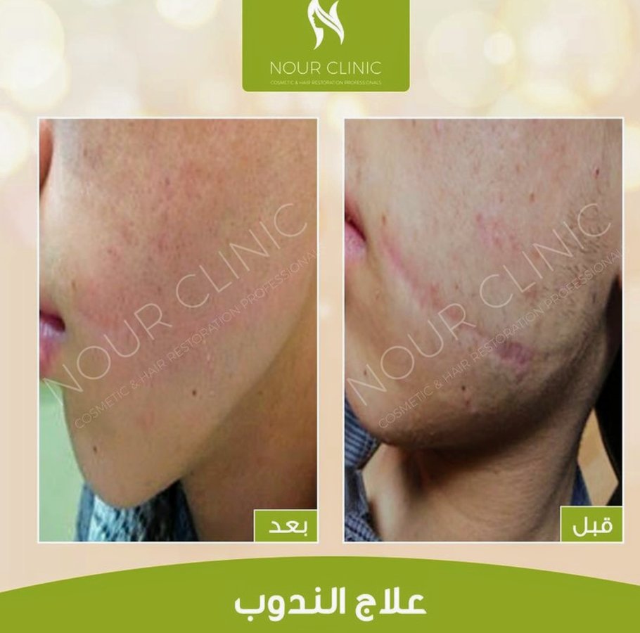 Nour Clinic - Nour Clinic