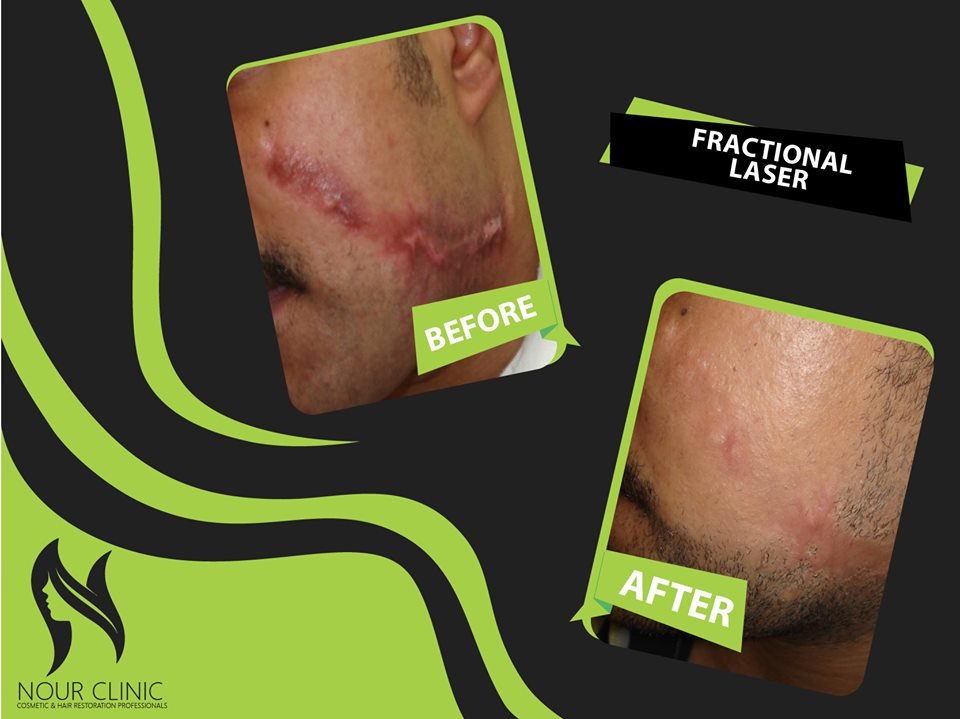 Nour Clinic - Nour Clinic