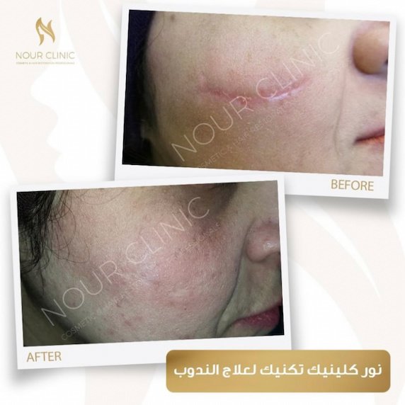 Nour Clinic - Nour Clinic