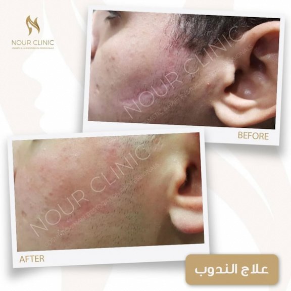 Nour Clinic - Nour Clinic