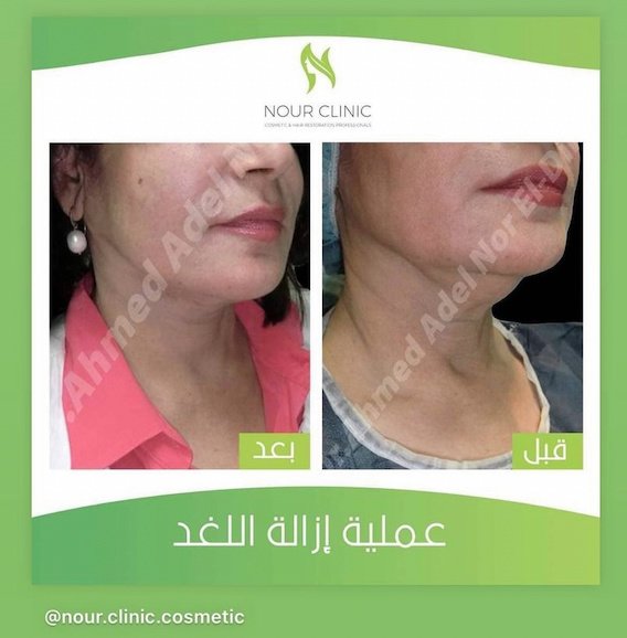 Nour Clinic - Nour Clinic