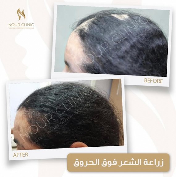 Nour Clinic - Nour Clinic