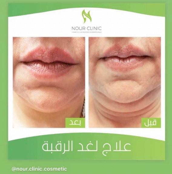 Nour Clinic - Nour Clinic