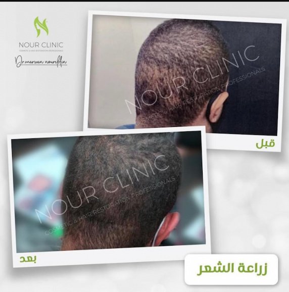 Nour Clinic - Nour Clinic