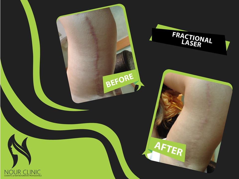 Nour Clinic - Nour Clinic