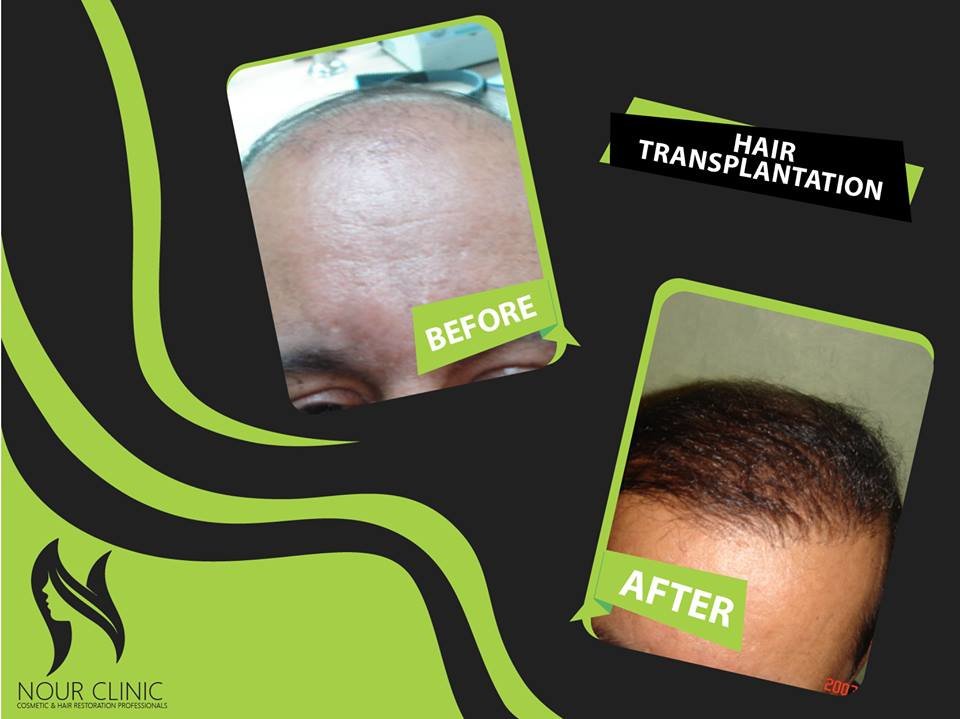 Nour Clinic - Nour Clinic