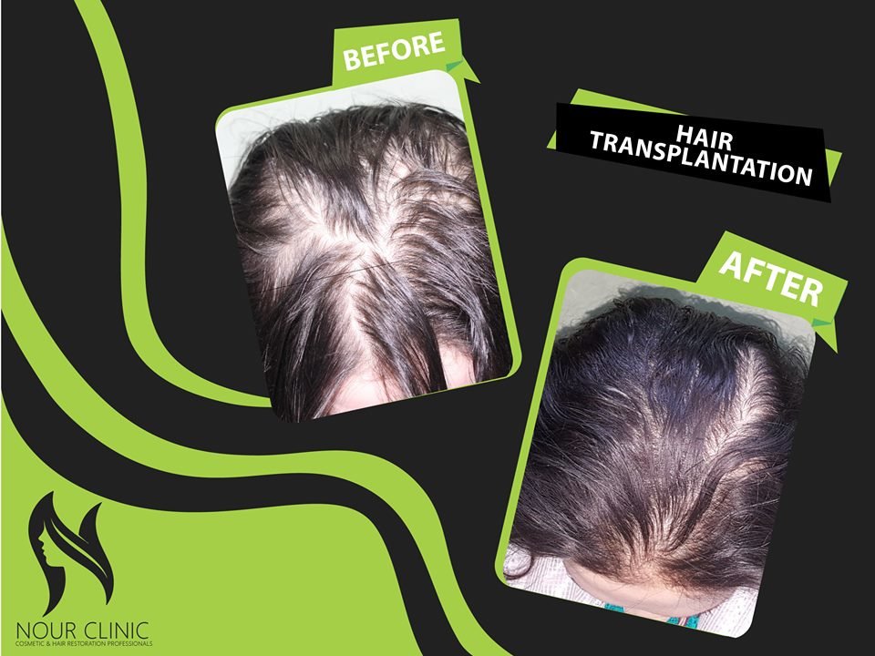 Nour Clinic - Nour Clinic