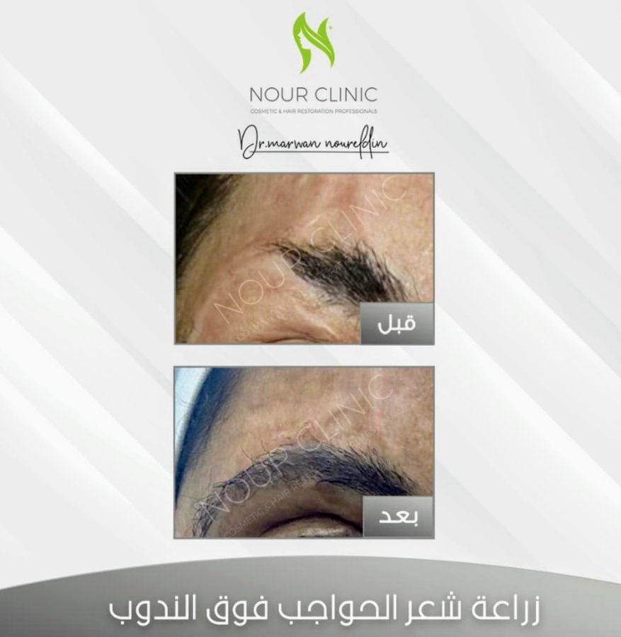 Nour Clinic - Nour Clinic