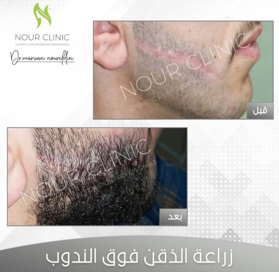 Nour Clinic - Nour Clinic