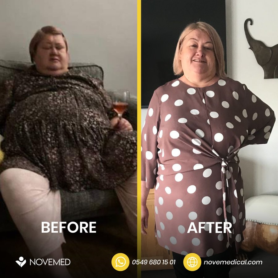Novemed Bariatric Center - Novemed Bariatric Center