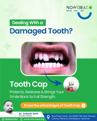 Nowtreat Clinic—Best Dental | Dentist | Skin Treatment | Hair Treatment Clinic in Varanasi - Nowtreat Clinic—Best Dental | Dentist | Skin Treatment | Hair Treatment Clinic in Varanasi