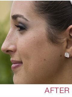 Nu Cosmetic Clinic Liverpool - Nu Cosmetic Clinic Liverpool