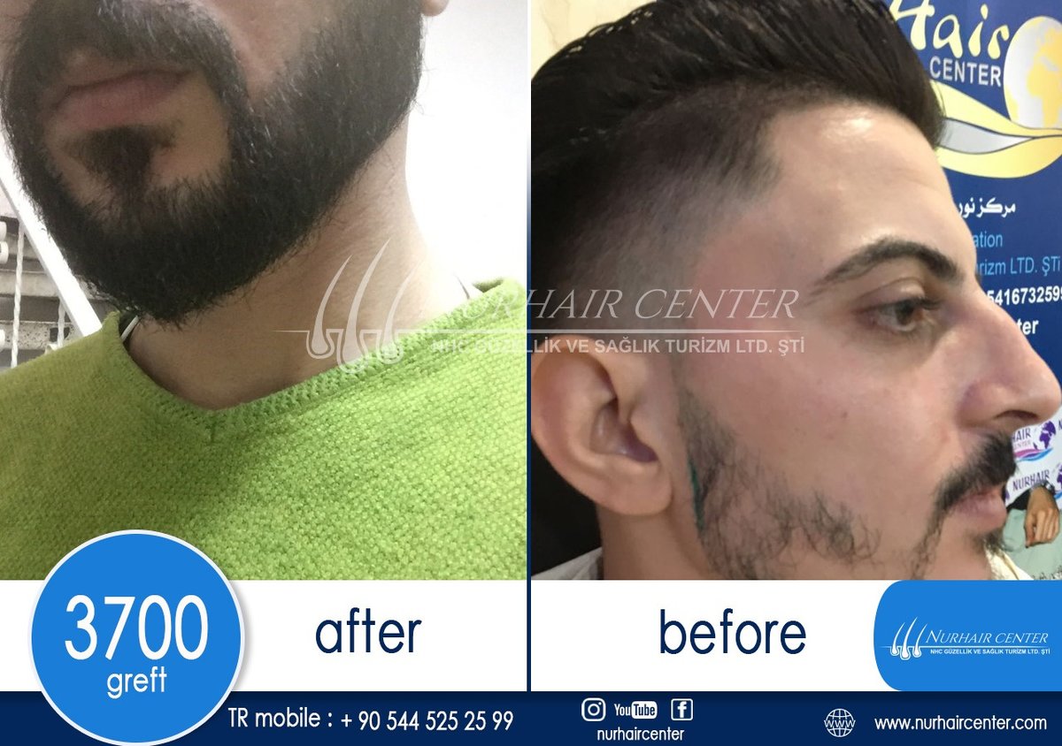 Nur Hair Center - Nur Hair Center