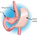 Obesidad y مرض السكري - Obesidad y Diabetes
