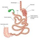 حلول السمنة والسمنة - Obesity Bariatric Solutions