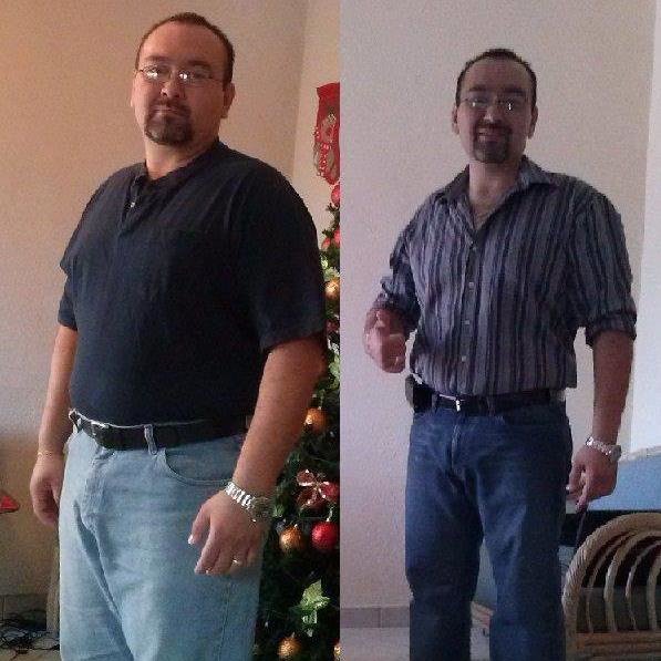 تغيير البدانة - Obesity Makeover
