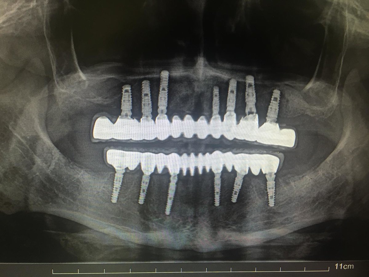 OkutanDis Halkali Dental Clinic - OkutanDis Halkali Dental Clinic